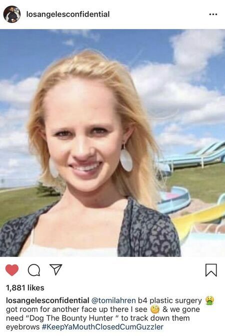 The Game shared a picture of Tomi Lahren on Instagram (now deleted) accusing her of plastic surgery.