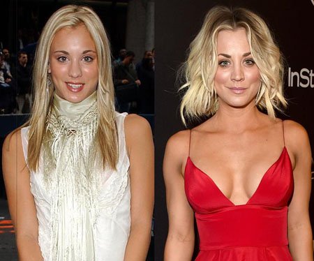 Kaley Cuoco Plastic Surgery; Breast Augmentation to her breasts to proportionate size.
