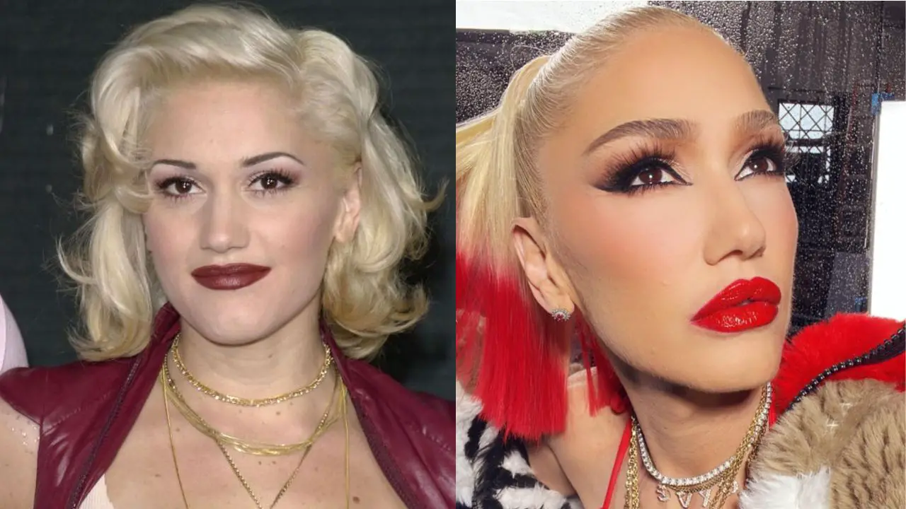 Gwen Stefani’s Plastic Surgery: Reddit Wonders About Botox, Fillers, Nose Job, Boob Job, Blepharoplasty, and Other Procedures; The Singer's Then and Now Changes!