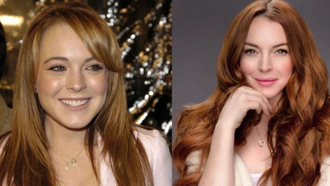 Lindsay Lohan's Plastic Surgery: Before and After Pictures Evaluated!
