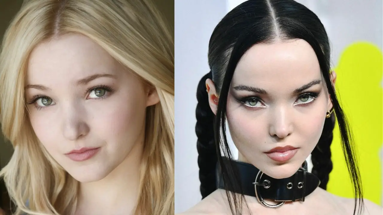 Dove Cameron Before and After Plastic Surgery: Reddit Users Discusses the Liv and Maddie Star Had Cheek Implants, Buccal Fat Removal, the Fox Eye Procedure, More Lip Fillers, a Chin Implant, and Rhinoplasty!