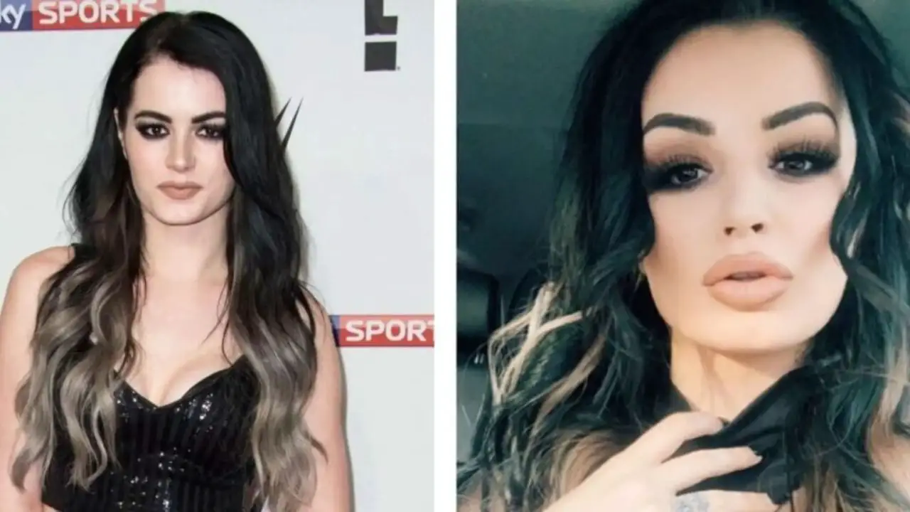 Saraya's Plastic Surgery: Paige’s Botox, Fillers, Lip Injections & Breast Augmentation With Before and After Instagram Pictures!