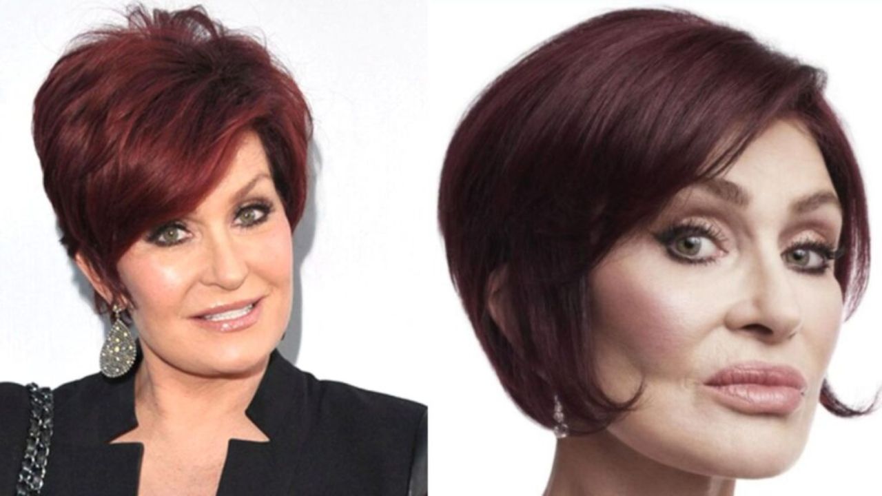 Sharon Osbourne’s Plastic Surgery: How Does She Look Today?