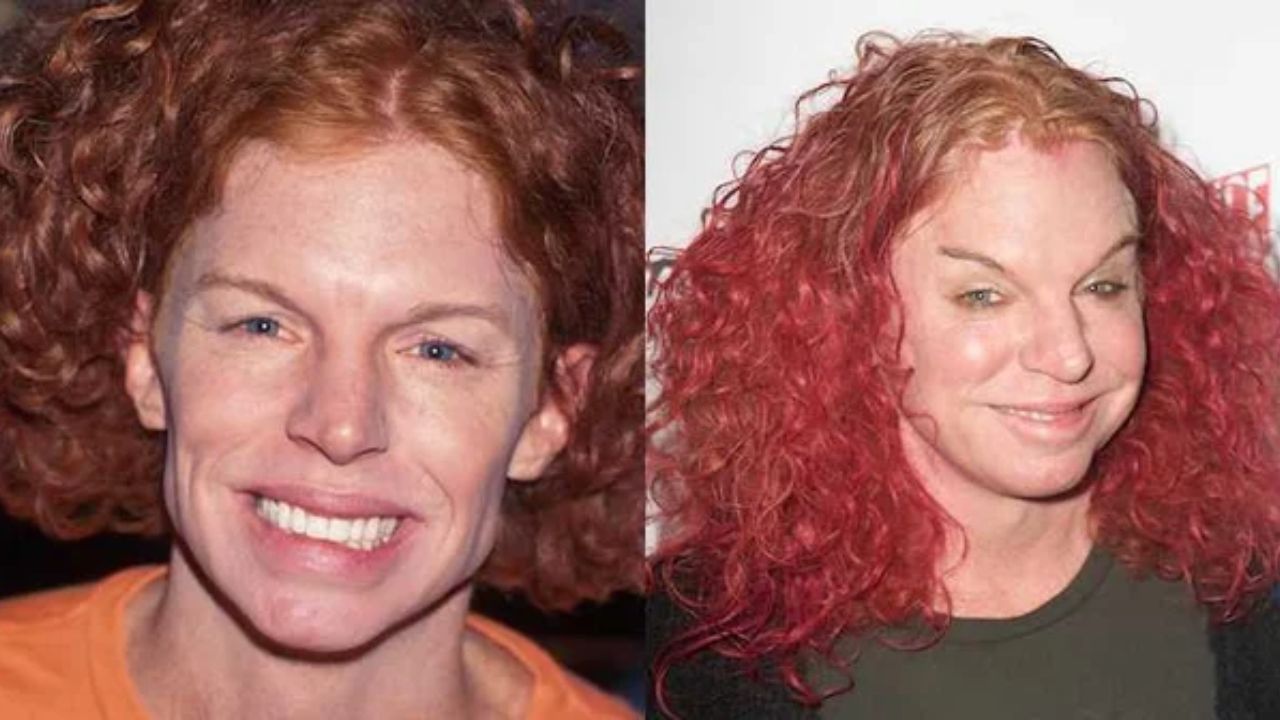 Carrot Top before and after plastic surgery.