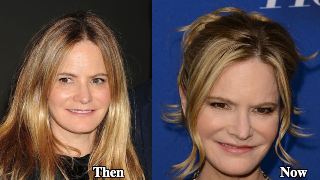 Jennifer Jason Leigh before and after plastic surgery. 