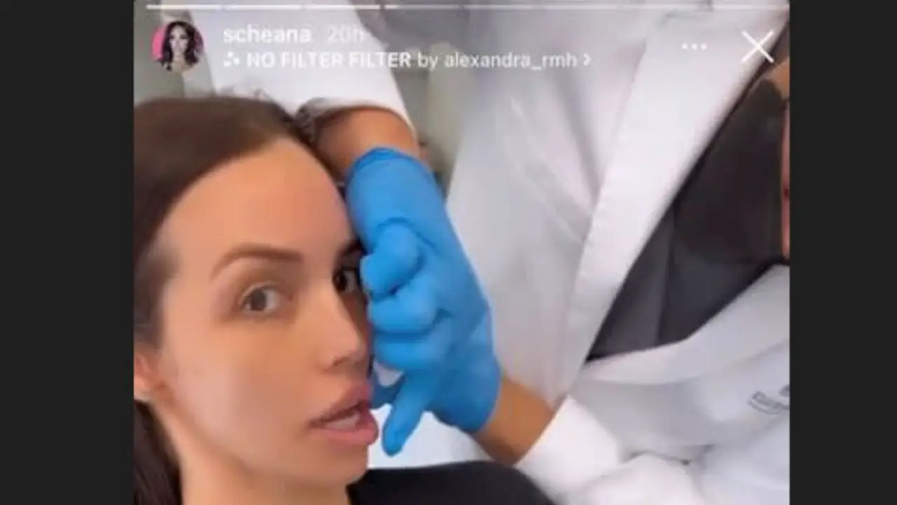 Scheana Shay shares a picture of getting lip fillers.