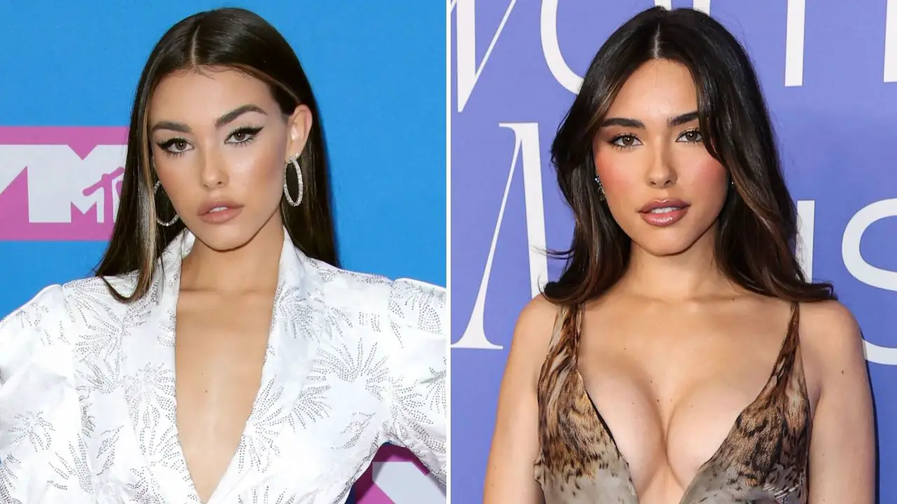 picture of Madison Beer before and after breast implants.