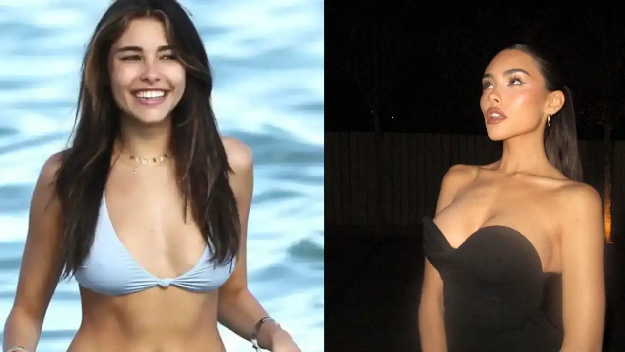 Did Madison Beer Have Breast Implants? Lip Fillers and Other Plastic Surgery Details!