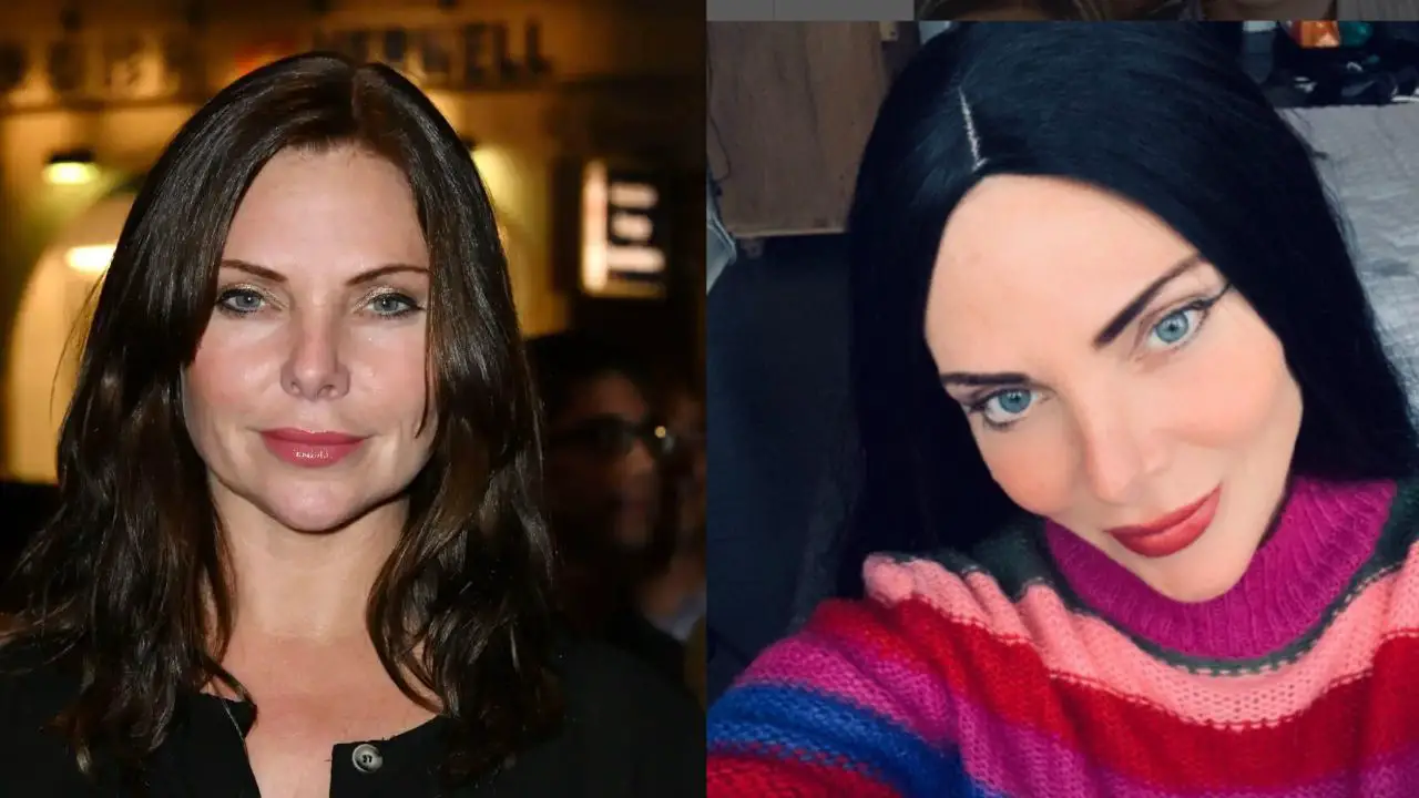 Samantha Womack's before and after plastic surgery.