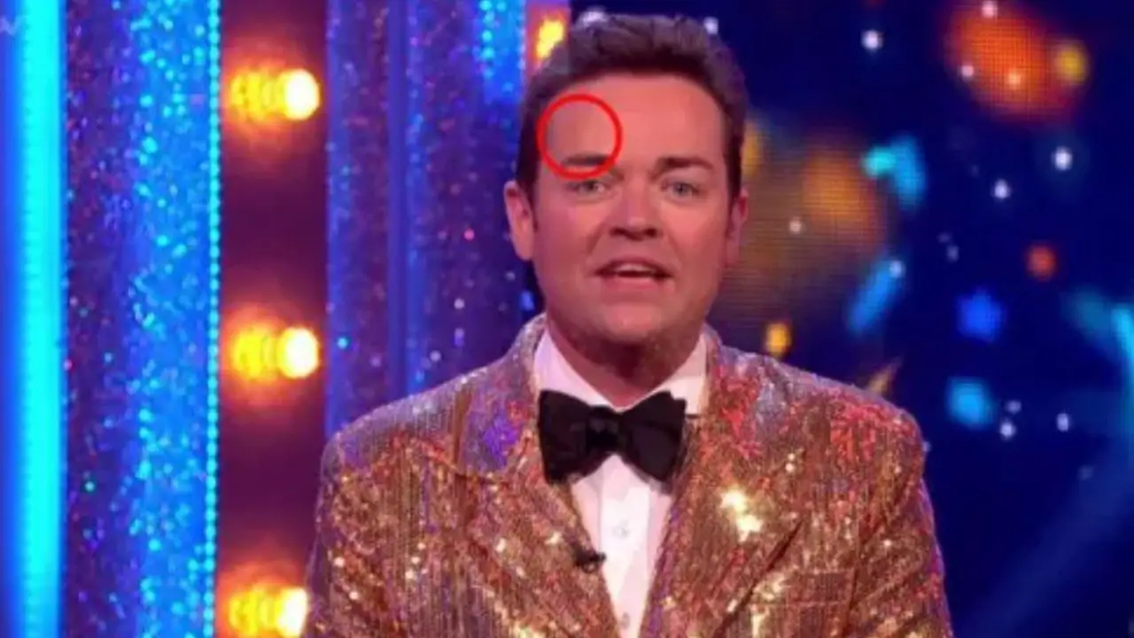 Stephen Mulhern's scar was caused when he was 11 years old. celebsindepth.com
