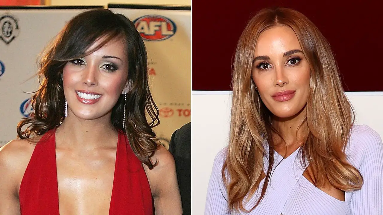 Bec Judd’s Plastic Surgery: Here Is What She Has to Say! celebsindepth.com