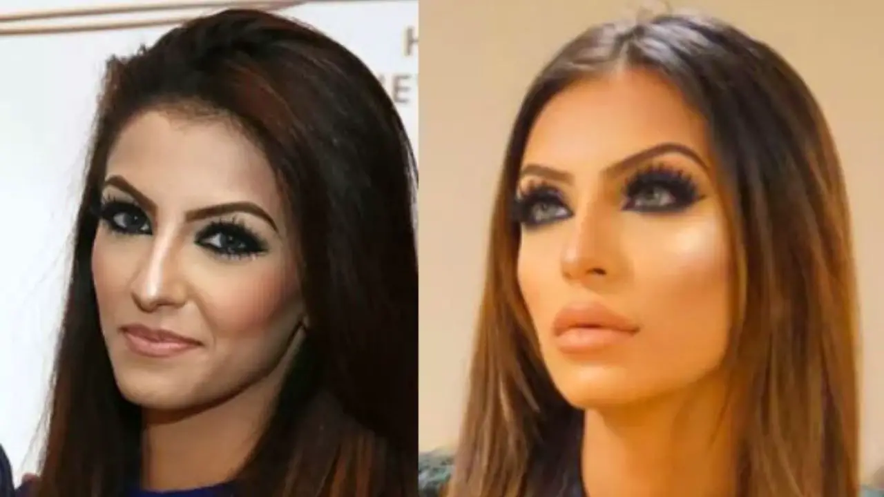 Faryal Makhdoom's before and after plastic surgery. celebsindepth.com