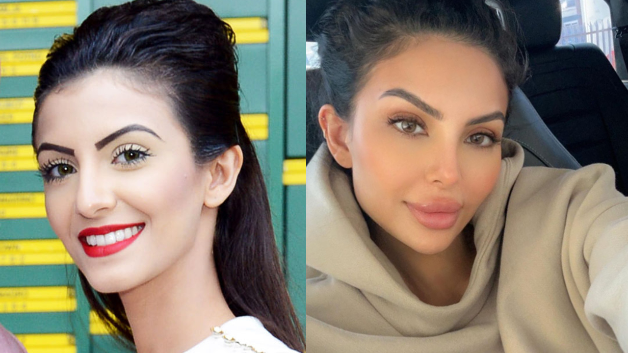 Faryal Makhdoom's Before Plastic Surgery: Her Current Appearance! celebsindepth.com