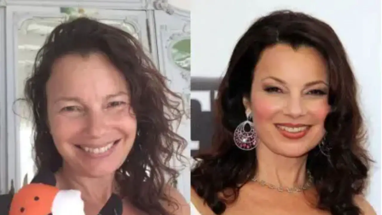Fran Drescher before and after plastic surgery. celebsindepth.com