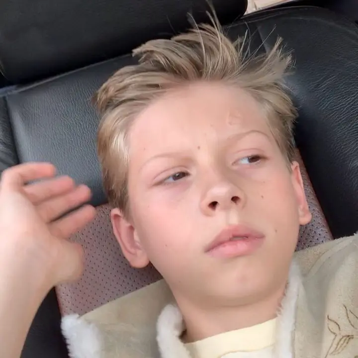 Mason Ramsey's scar on his forehead has not affected his career. celebsindepth.com