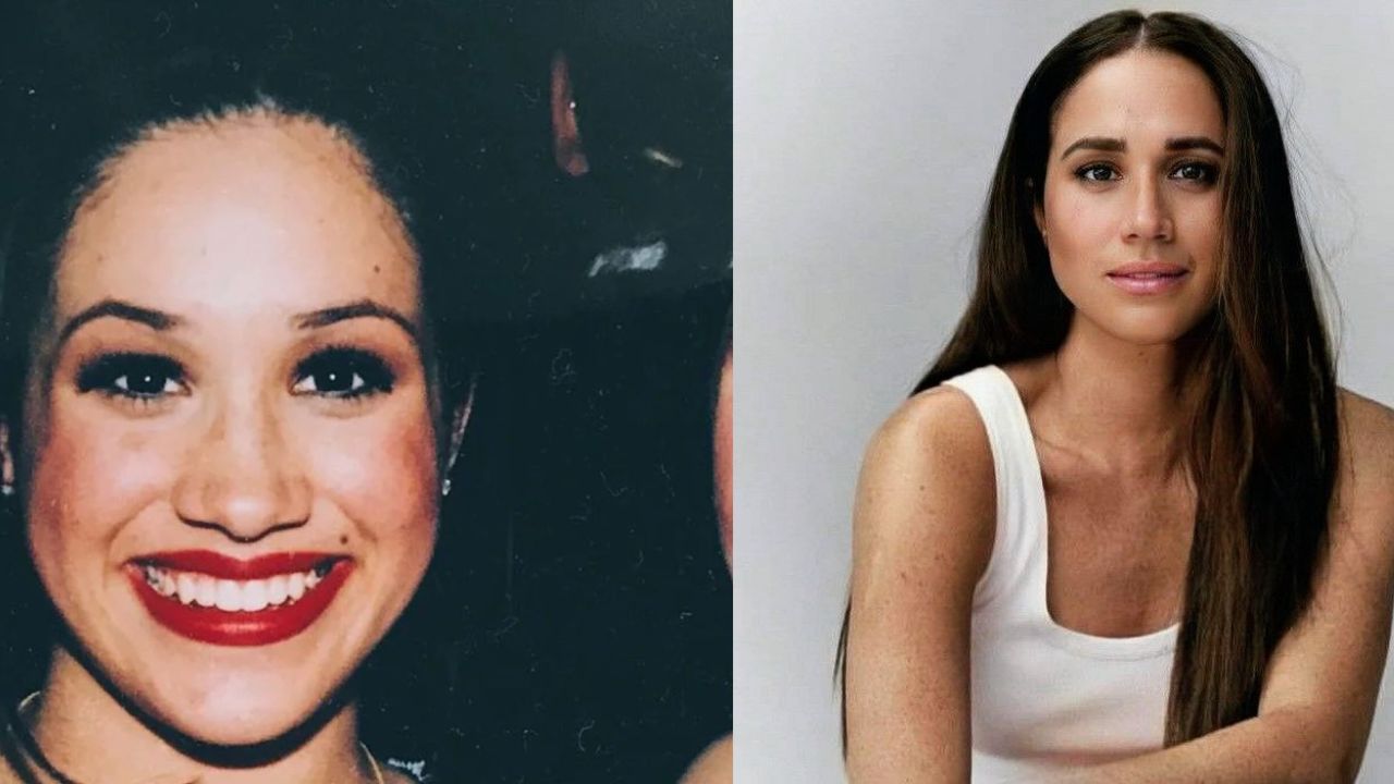 Meghan Markle’s Nose Job: Before and After Plastic Surgery! celebsindepth.com