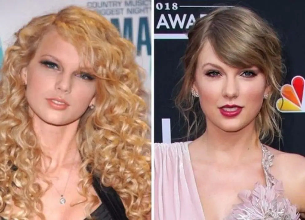 Taylor Swift's appearance has changed after undergoing plastic surgery. celebsindepth.com