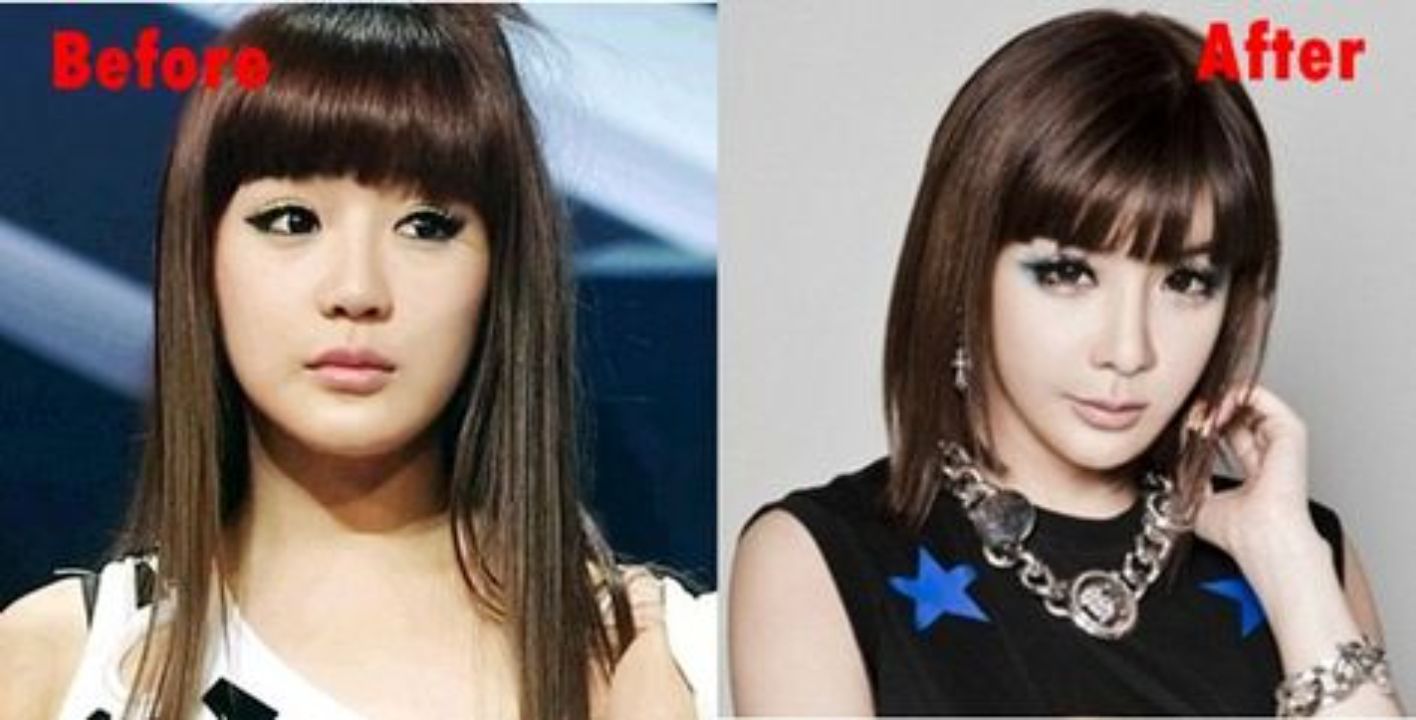 Park Bom's before and after plastic surgery. celebsindepth.com