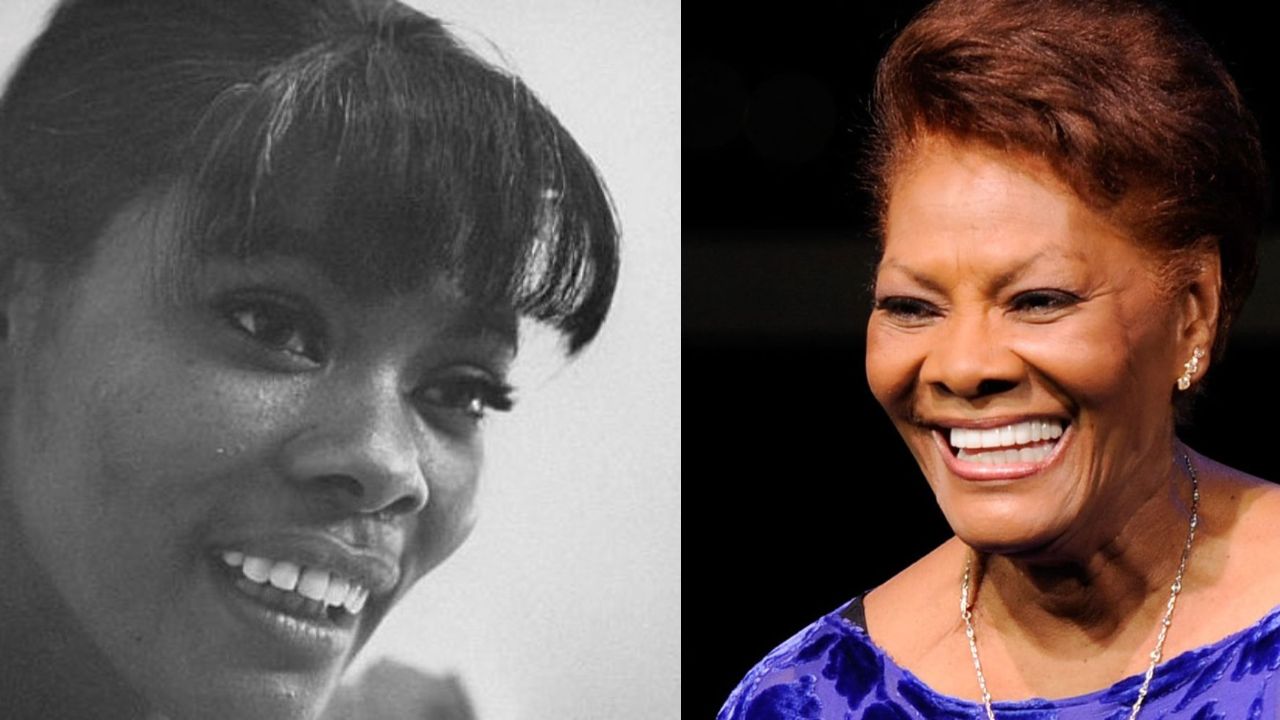 A Look at Dionne Warwick’s Teeth Before and After Pictures celebsindepth.com