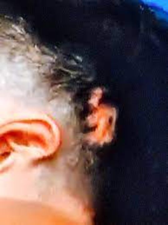 Horacio's head scar is quite noticeable. celebsindepth.com