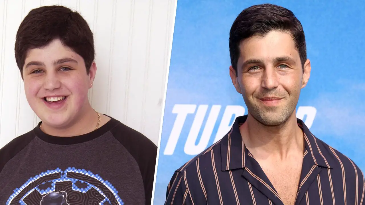 Josh Peck's before and after plastic surgery. celebsindepth.com 