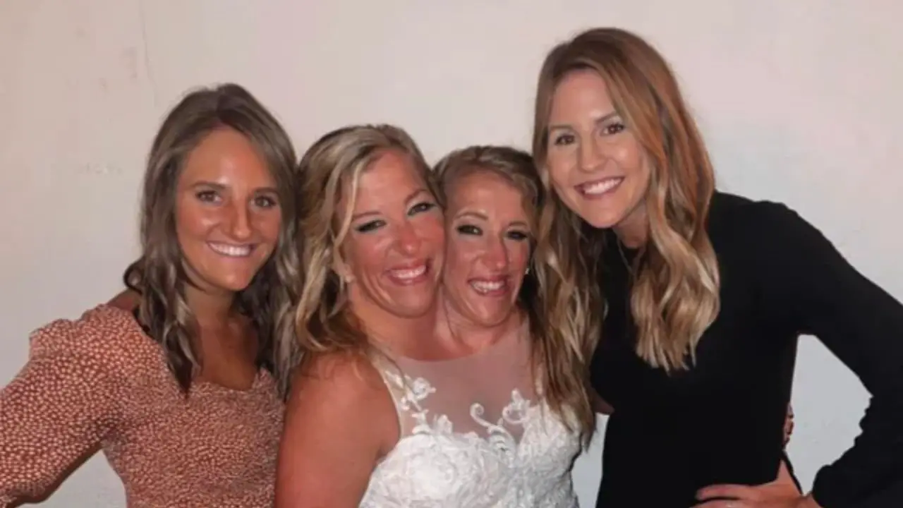 Abby and Brittan are not pregnant. celebsindepth.com