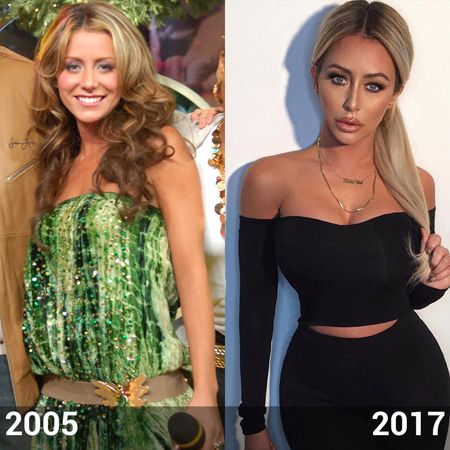 Aubrey O'Day full body plastic surgery comparison.