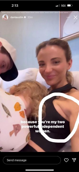 For years, Dani Austin has been suspected of having breast augmentation. celebsindepth.com 