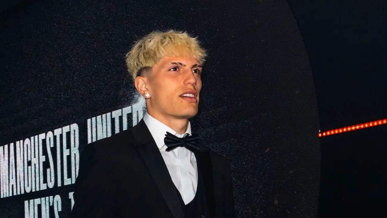 After fixing his teeth, Alejandro Garnacho looks better. celebsindepth.com
