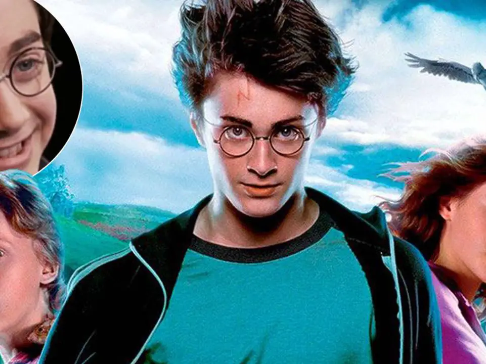 Harry Potter's scar symbolizes his emotional sensitivity. celebsindepth.com