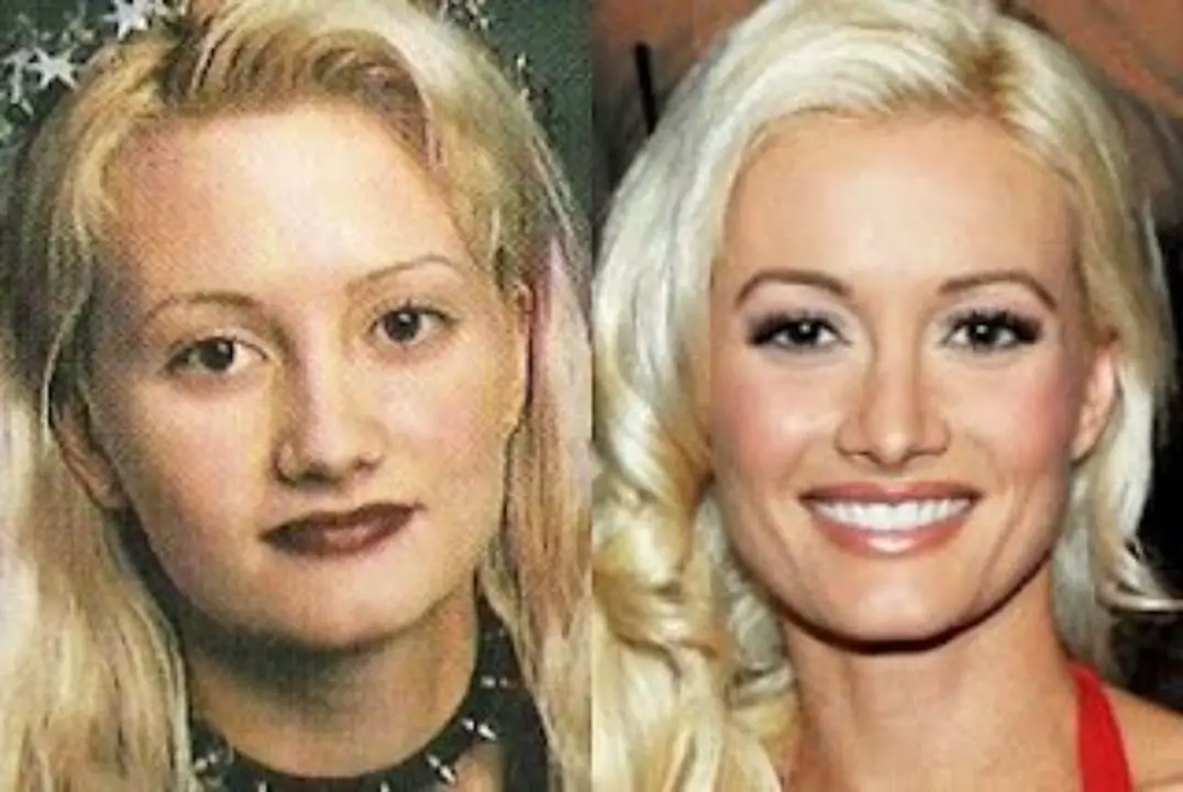 Holly Madison before and after the nose job. celebsindepth.com
