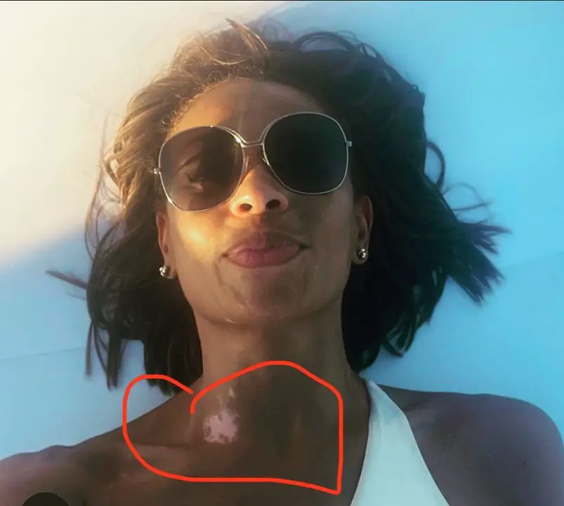 Ilia Calderon shared a post talking about her scar on her neck. celebsindepth.com