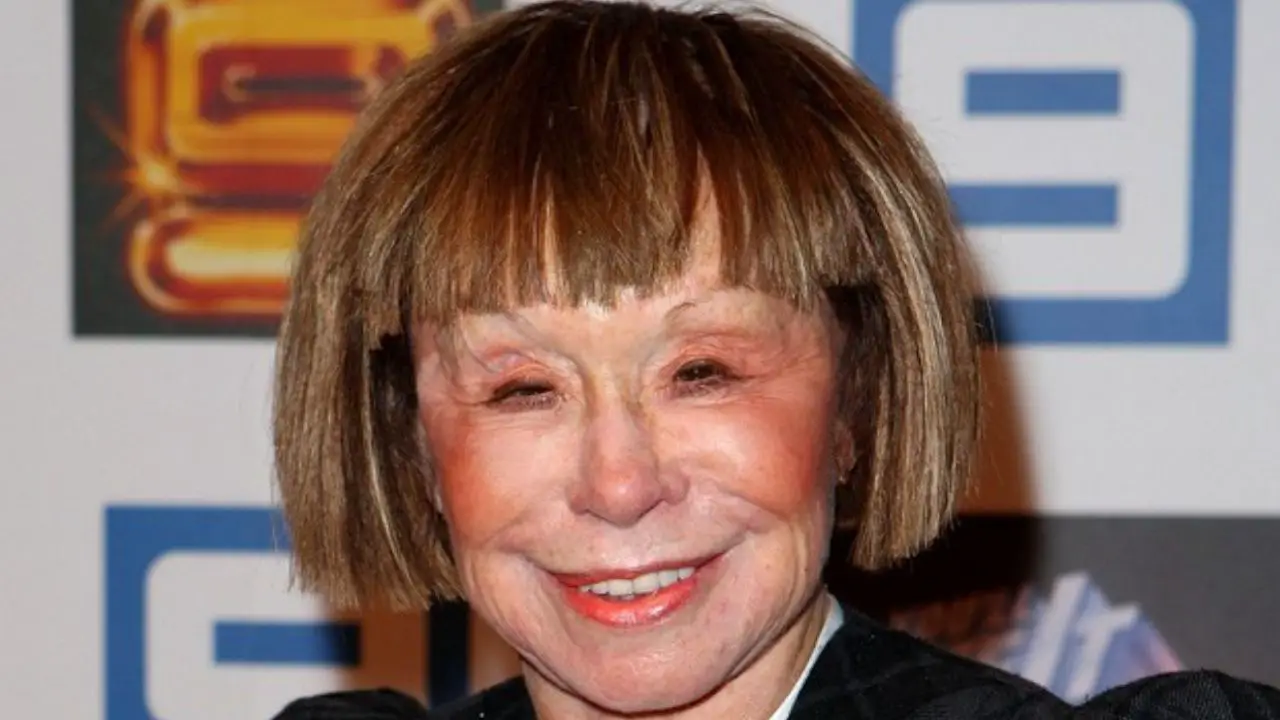 Jeanne Pratt's appearance after plastic surgery. celebsindepth.com