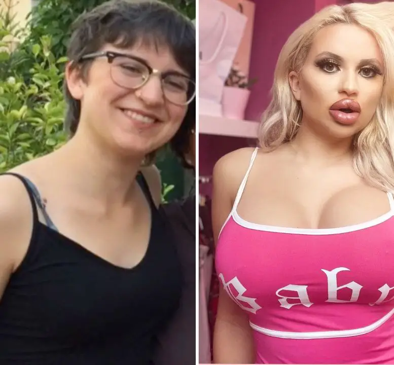 Jessy Bunny had breast augmentations, rhinoplasty, lip fillers, and buttock fillers. celebsindepth.com