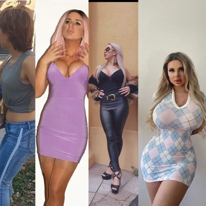 Jessy Bunny's comparison picture of plastic surgery. celebsindepth.com