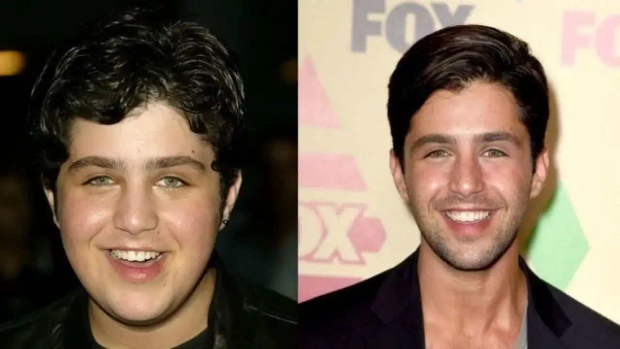 Josh Peck looks different due to plastic surgery. celebsindepth.com