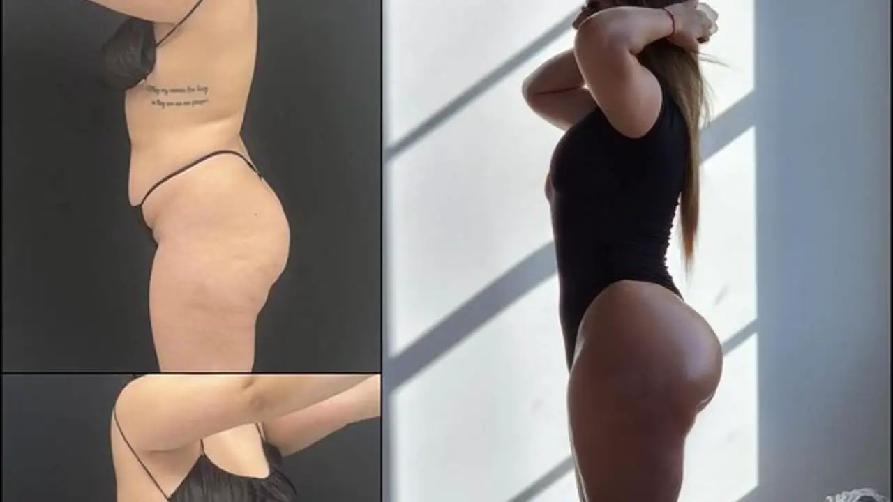 Leila Penn's exact plastic surgery procedure is unknown. celebsindepth.com