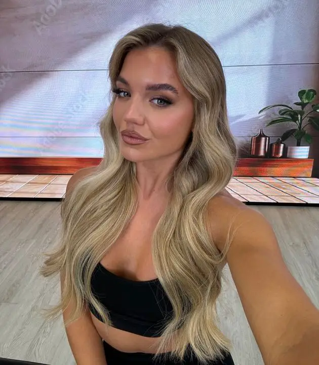 Molly Smith has denied having Botox. celebsindepth.com