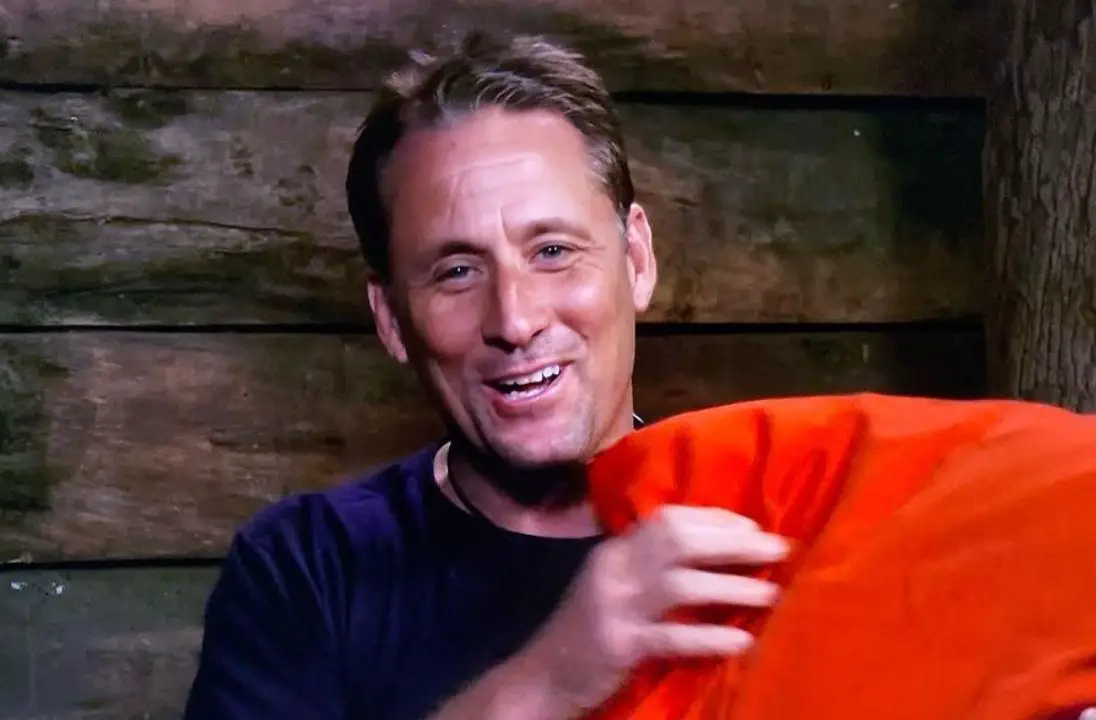 Nick Pickard has a small cut, leaving behind a scar. celebsindepth.com