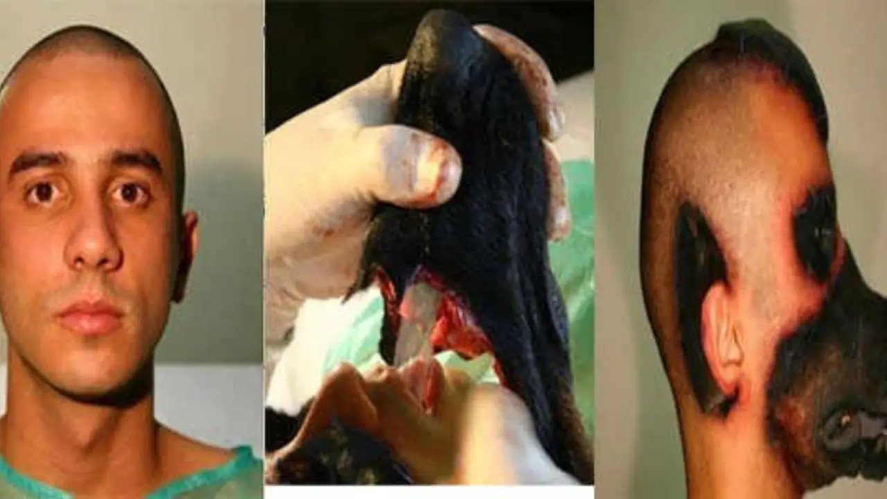 Rodrigo Braga's plastic surgery photos resembling dog faces were altered using software. 