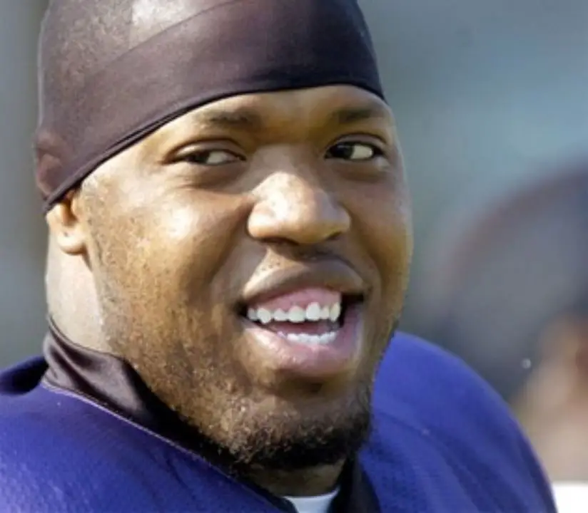 Terrell Suggs' teeth before doing the procedure. celebsindepth.com