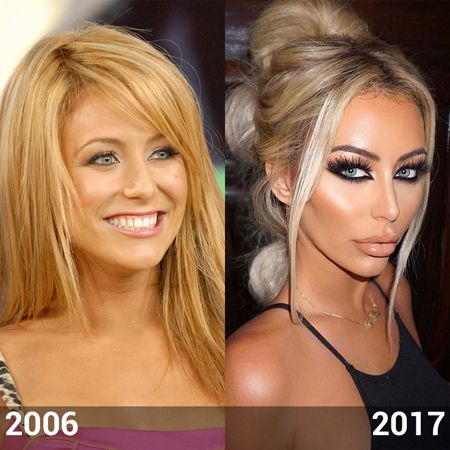 Aubrey O'Day photo comparison between 2007 and 2017; looking at her lips.