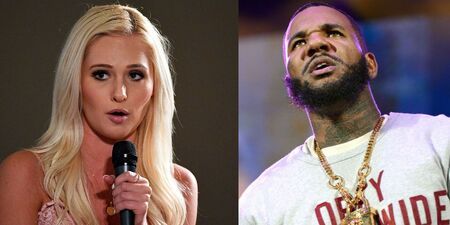 The Game accused Tomi Lahren of plastic surgery.