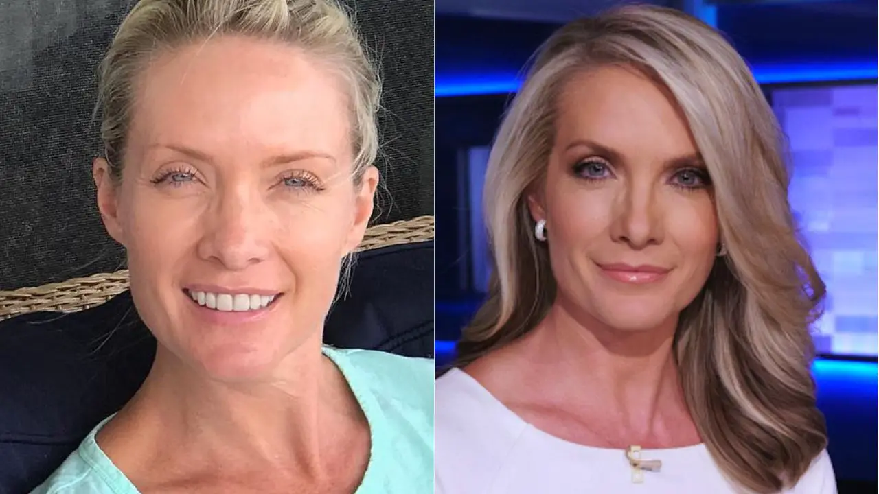 Dana Perino's Plastic Surgery: Facelift, Botox, Fillers, Blepharoplasty, Nose Job; The Five Co-host Before & After Pictures Examined!