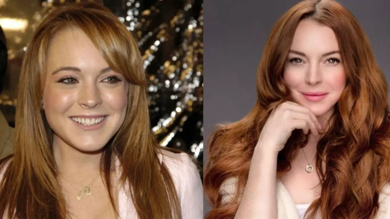 Lindsay Lohan's Plastic Surgery: Before and After Pictures Evaluated!
