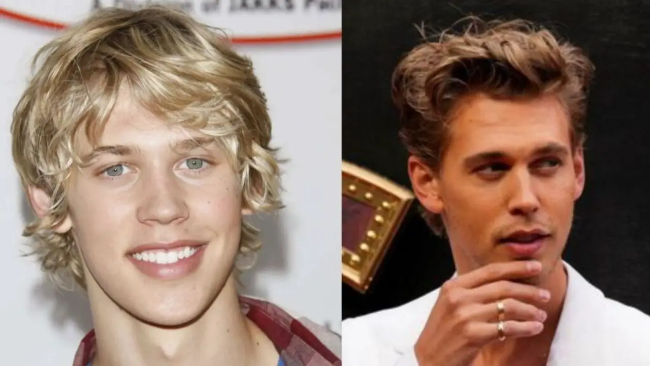 Austin Butler’s Plastic Surgery: Did the Elvis Movie Star Go Under the Knife? How Does He Look So Young and What Happened to His Lips?