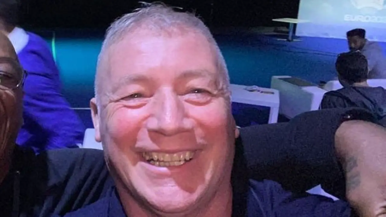 Something is wrong with Ally McCoist's new teeth. celebsindepth.com