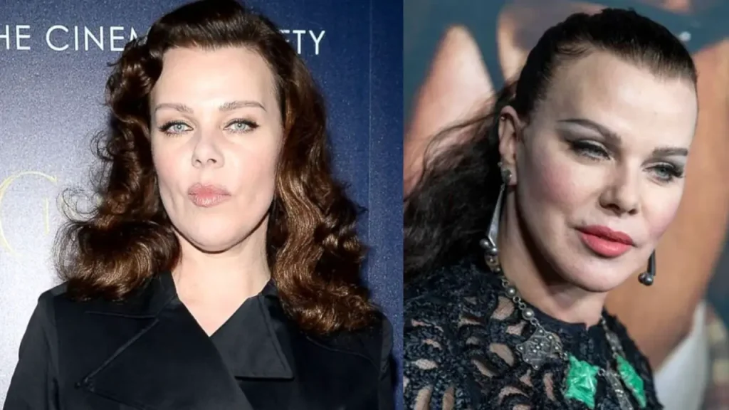 Debi Mazar’s Plastic Surgery The East New York Cast Admits to