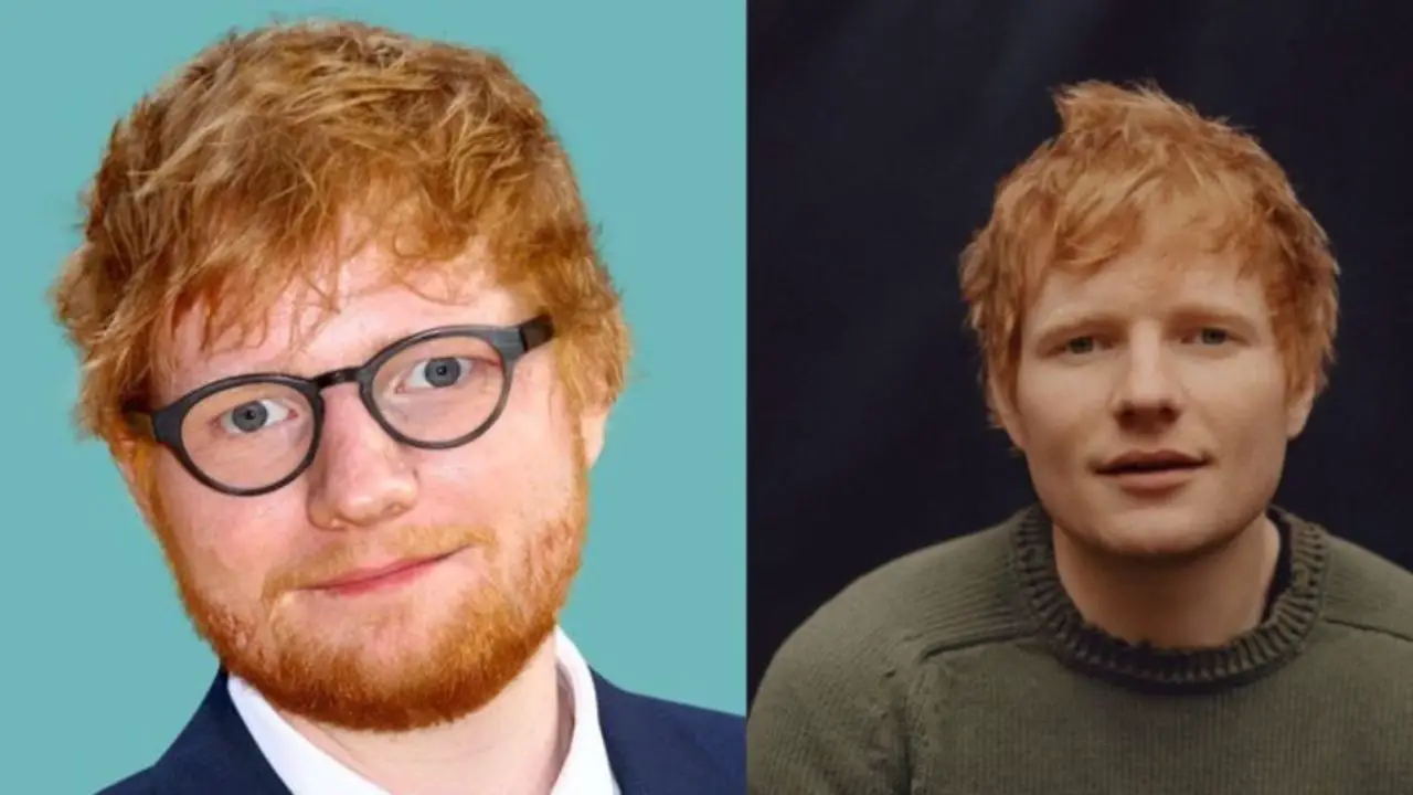 Ed Sheeran’s Plastic Surgery: Despite Being Speculated To Have ...