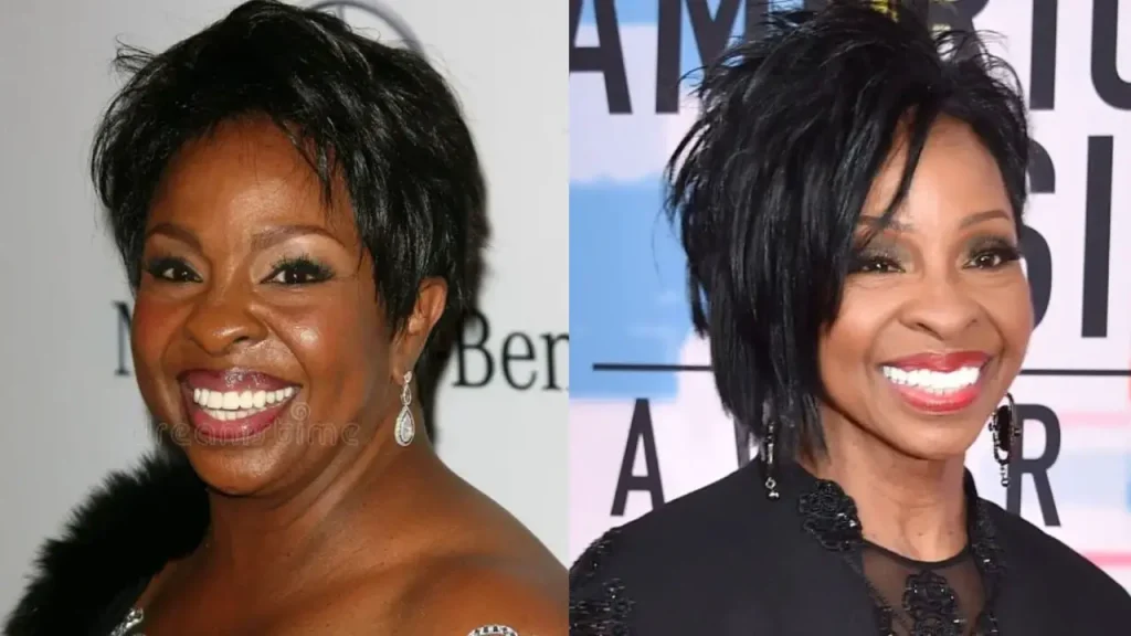 gladys knight plastic surgery Image 8